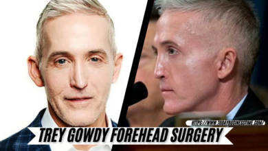 trey gowdy forehead surgery